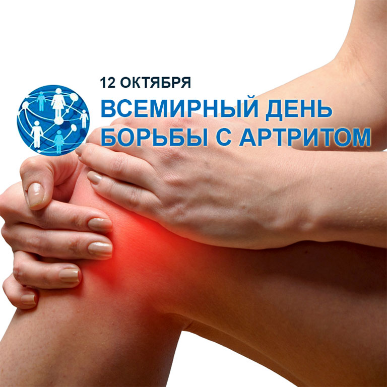 Всемирный день борьбы с артритом